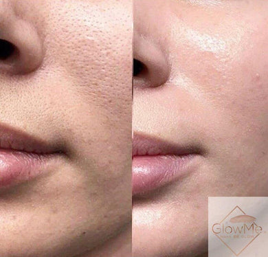 BB Glow Models Registration - ONLY $99 REGULAR PRICE $299