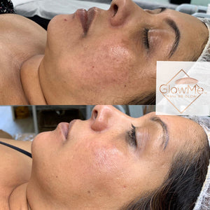 BB Glow Models Registration - ONLY $99 REGULAR PRICE $299