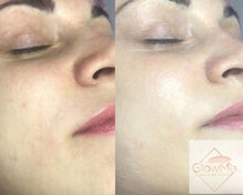 Load image into Gallery viewer, BB Glow Models Registration - ONLY $99 REGULAR PRICE $299